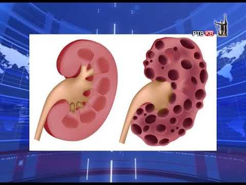 Prilog RTVKV Medikus Univerzalis nefrologija