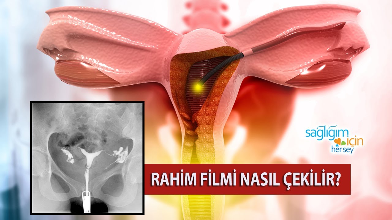 Rahim Filmi Nasıl Çekilir?