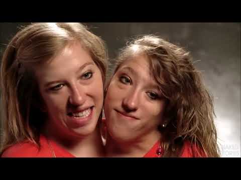 Abby and Brittany Hensel: Conjoined Twins - Quick Q&A Video