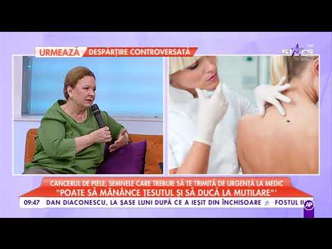 cancer de piele obraz que es oxiuros en biologia