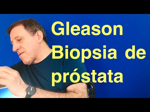 Csipkebogyó a prostatitis receptből