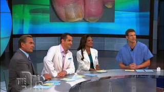 The Doctors on Laser Toenail Fungus Removal