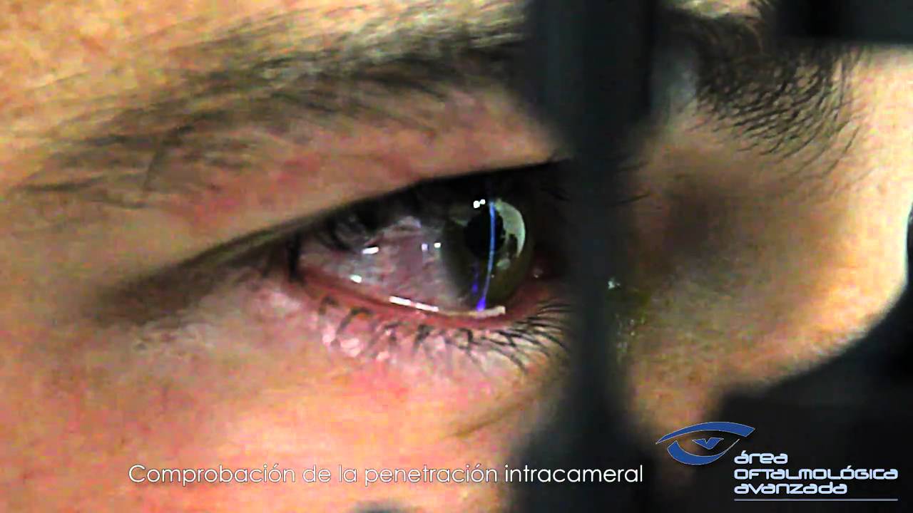 Rafael Ortiz Zavala-33