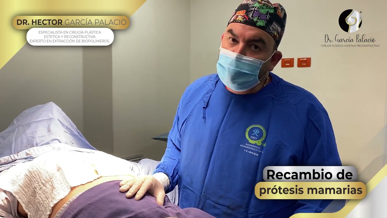 Watch Recambio de prótesis mamarias Now Recambio de prótesis mamarias