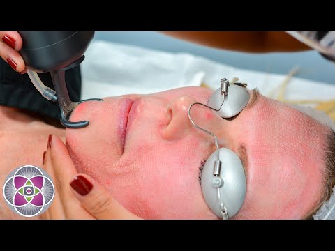 The Science of Erbium and CO2 Fractional Laser Resurfacing