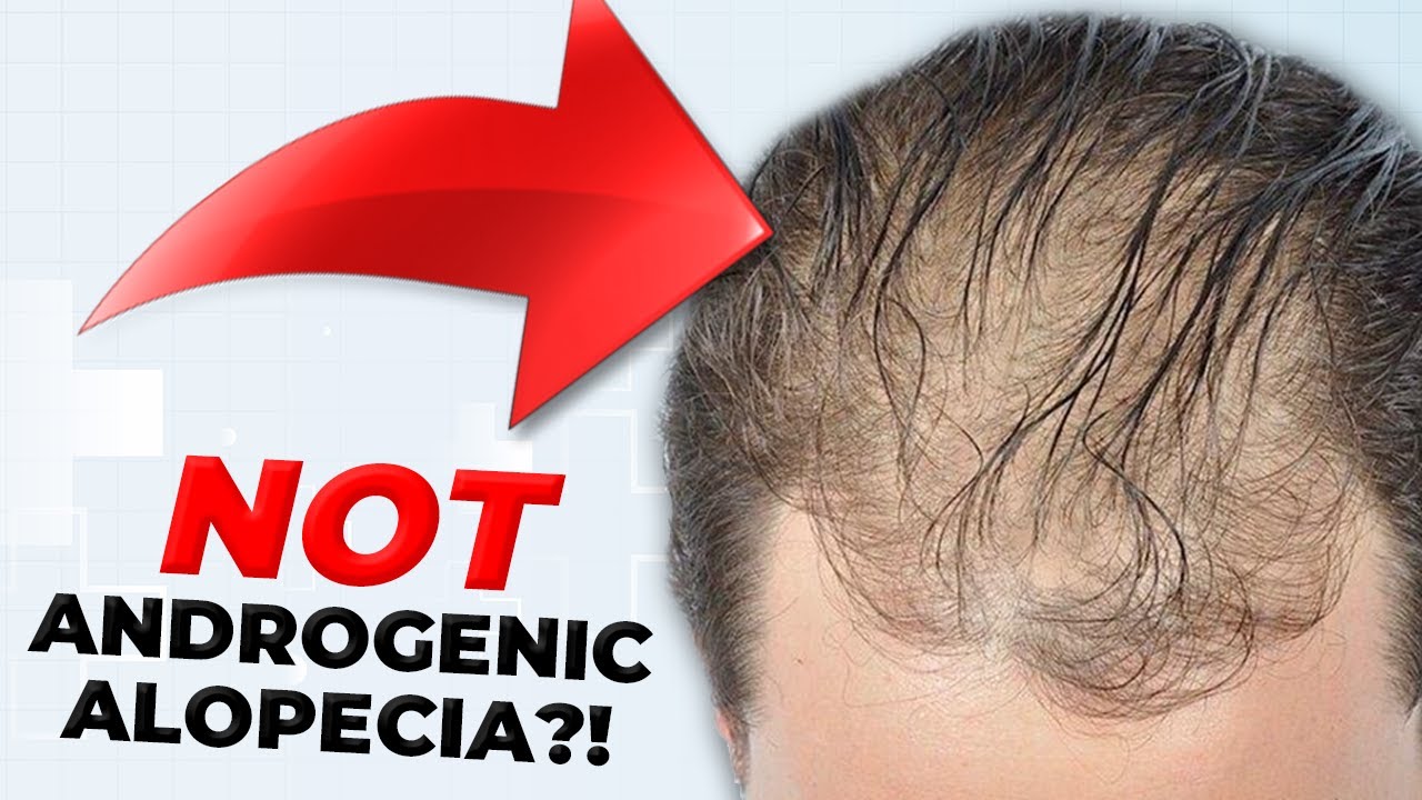 Misdiagnosed for 10+ years... until now.