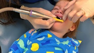 She Has a Vampire Tooth!!