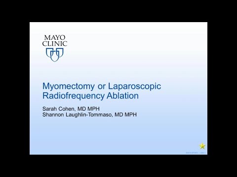 Myomectomy or Laparoscopic Radiofrequency Ablation by Sarah L. Cohen, MD | Preview