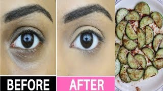 How to Remove Dark Circles Naturally in 3 Days|100% Results|काले घेरों से छुटकारा पाएं