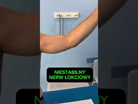 Niestabilny nerw łokciowy #fizjoidea #fizjoterapia #nerw #łokieć