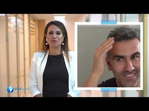 Frequently Asked Questions in Hair, Beard and Eyebrow Transplantation | Selda Hair Center