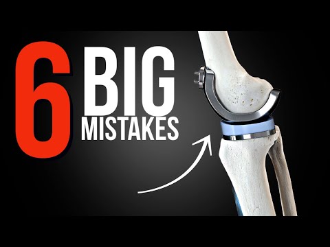 6 MISTAKES You Should NEVER Make After Knee Replacement