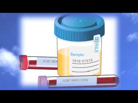 Your Environmental Minute 19 - "Chronic Fatigue Syndrome"