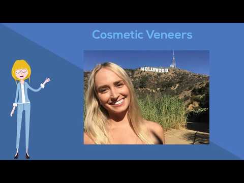 Cosmetic Veneers