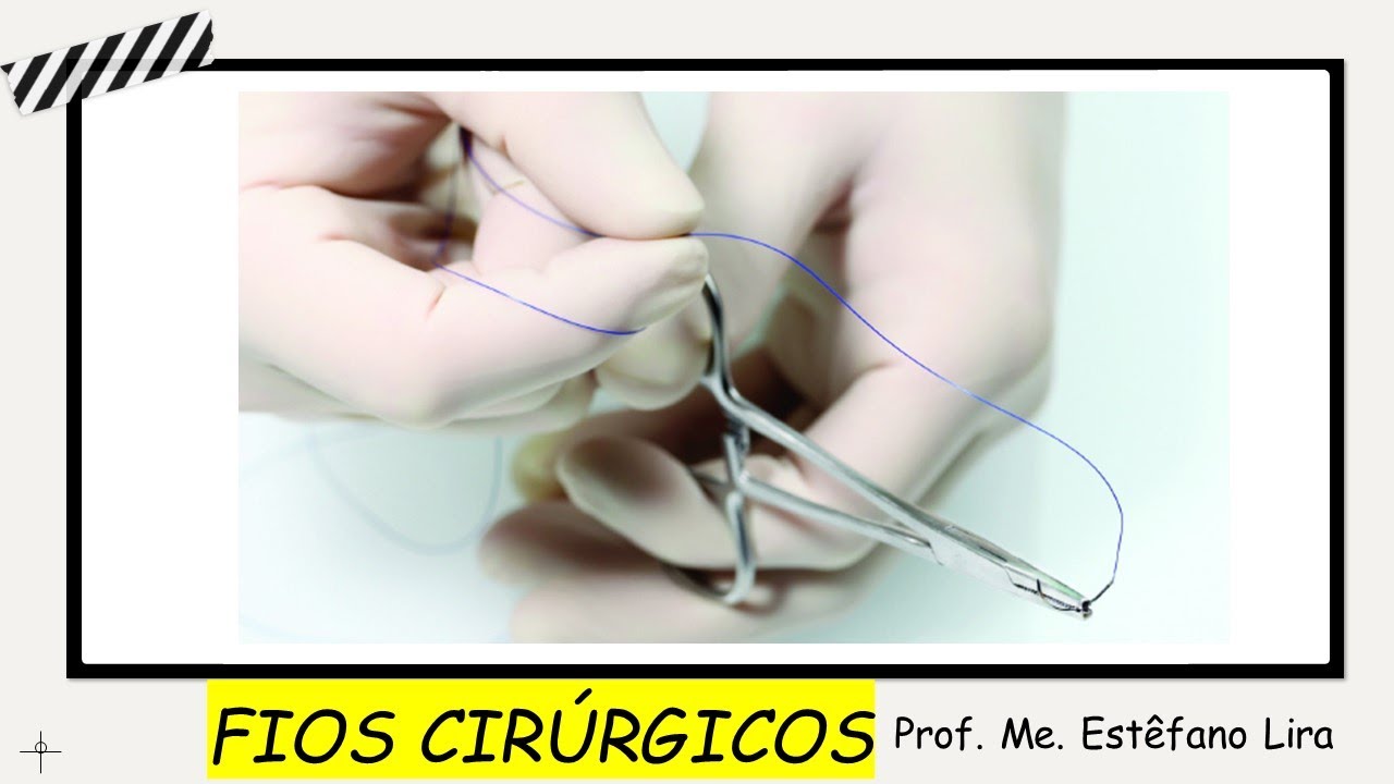 FIOS CIRÚRGICOS