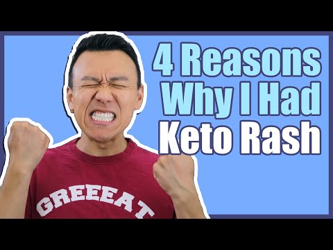 4 Potential Reasons Why I Had Keto Rash