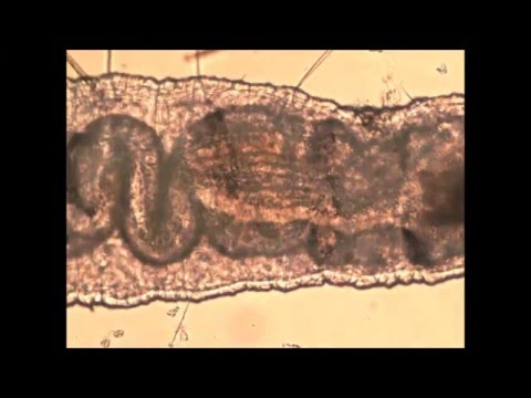 Quali parassiti è in intestini Come eliminare vermi a un cucciolo da un metodo nazionale