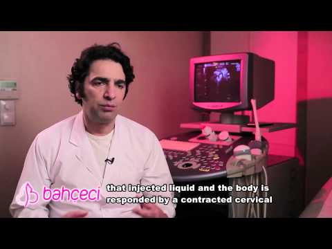 Is HSG shooting a painful operation? What can be done for it?