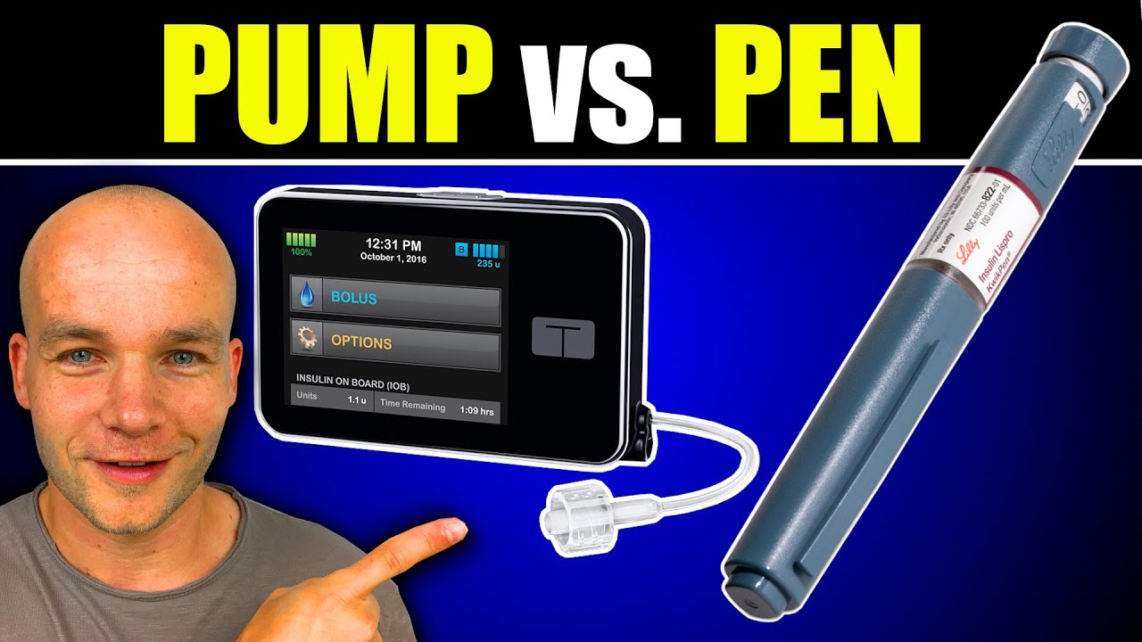 Should You Switch From MDI to Insulin Pump? 22 Years of Real Talk