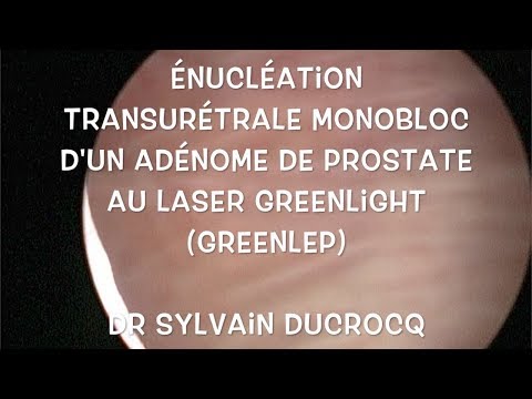 Wie Potenz nach Prostata-Operation zur Wiederherstellung Prostate Oncology Treatment Volk
