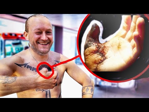JARPPI'S THE WORST ACCIDENT! (Dudesons)