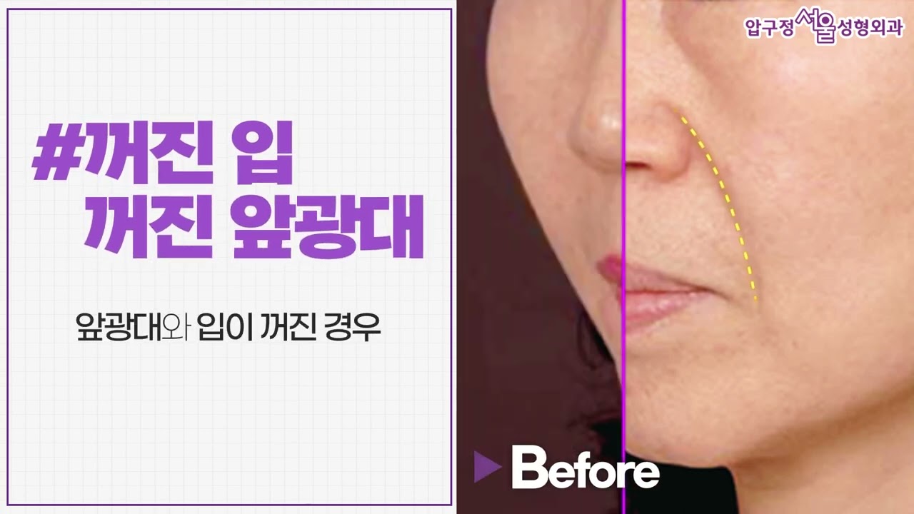 �� �����ָ��� ������?