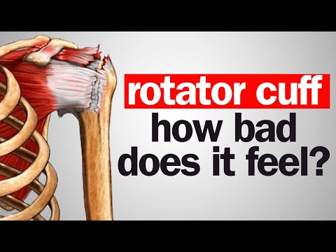How BAD Does a Torn Rotator Cuff Actually Feel?