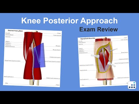 Knee Posterior Approach Exam Review - Ron Delanois, MD