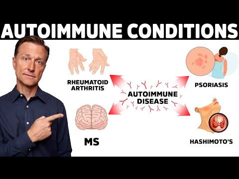 Multiple Sclerosis MS and Stem Cell Therapy OKAY