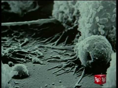 Cera allatto di cura di eczema Leczema in una bocca che fare