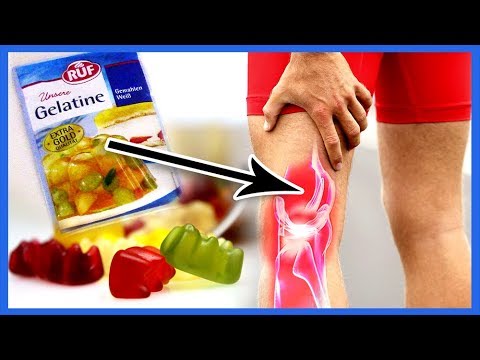Orthopädische Hüftschmerzen Klassifizierung von Hüftdysplasie