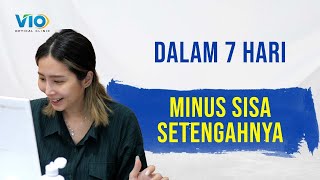 Download lagu MINUS TURUN SETENGAHNYA DALAM 7 HARI DENGAN TERAPI ORTHO K mp3