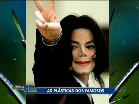 Tudo a Ver 23/08/2012: Veja quais celebridades se deram mal nas cirurgias plásticas