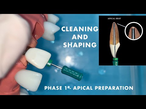 Preclinical Laboratory Dentistry - Cleaning And Shaping - Apical Preparation