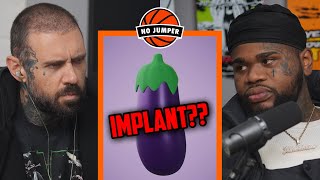 Adam Asks Fatboy If He Really Got a 🍆 Implant