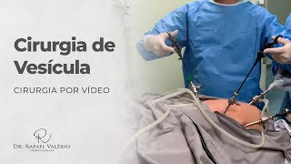 Cirurgia Real de Vesícula por Vídeo