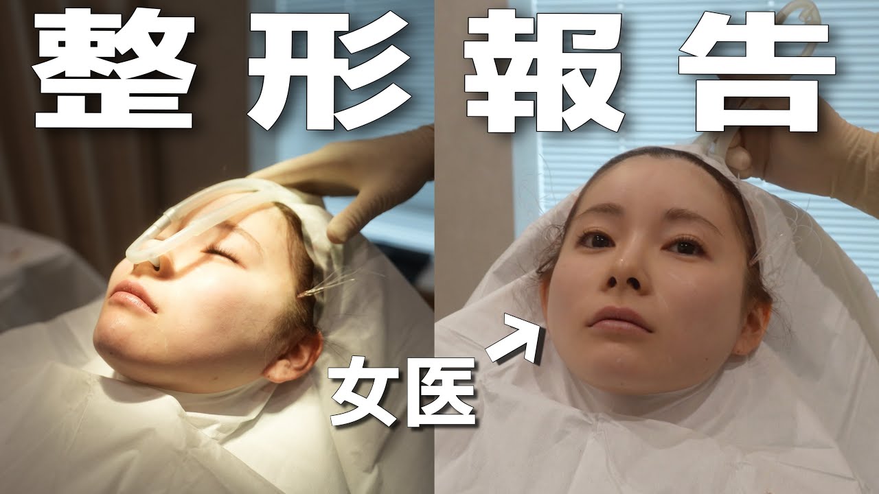 美女妻が、整形しました。 