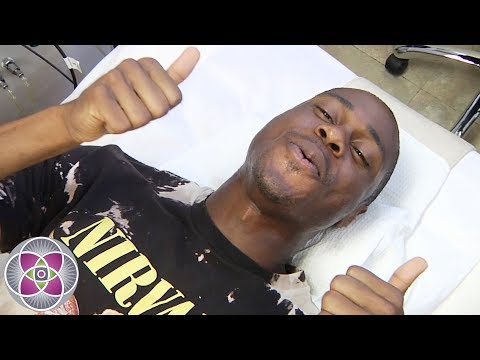 download lagu mp3 mp4 More Ingrown Hairs After Laser, download lagu More Ingrown Hairs After Laser gratis, unduh video klip More Ingrown Hairs After Laser