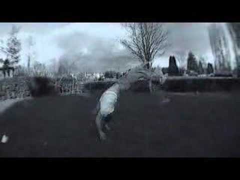 Ryan Doyle - 1 leg combo (broken left leg 2007)