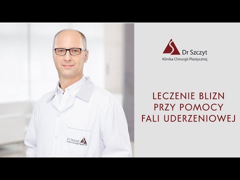 Leczenie blizn falą uderzeniową