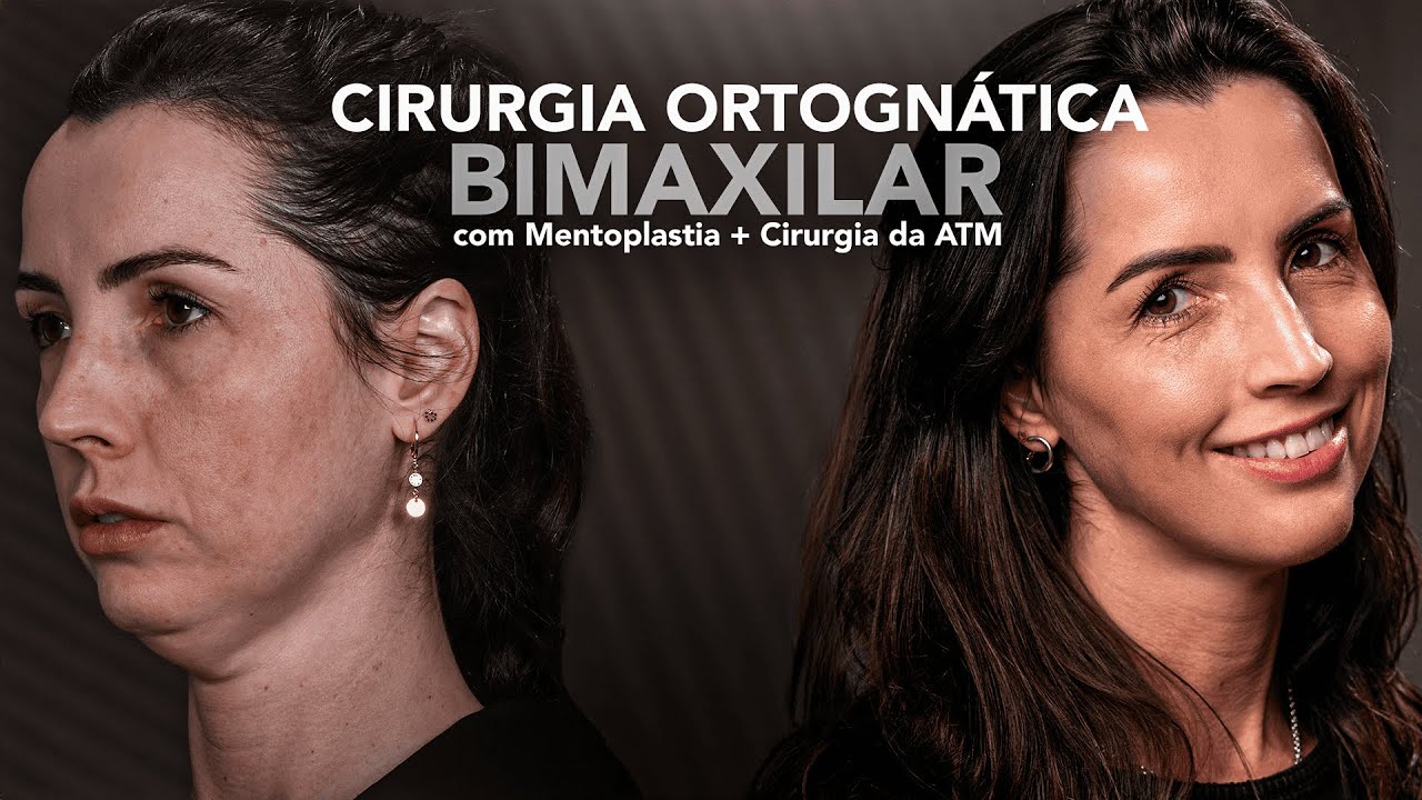 João Pedro Paulino Mazzon-84