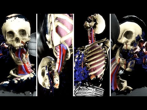 Mortal Kombat 9: Komplete Edition - All X-Ray Attacks