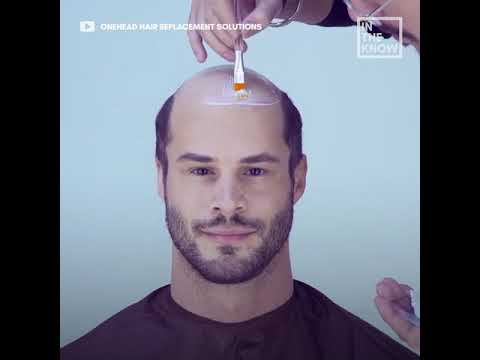 Ultra realistic hair pieces give bald men hair again
