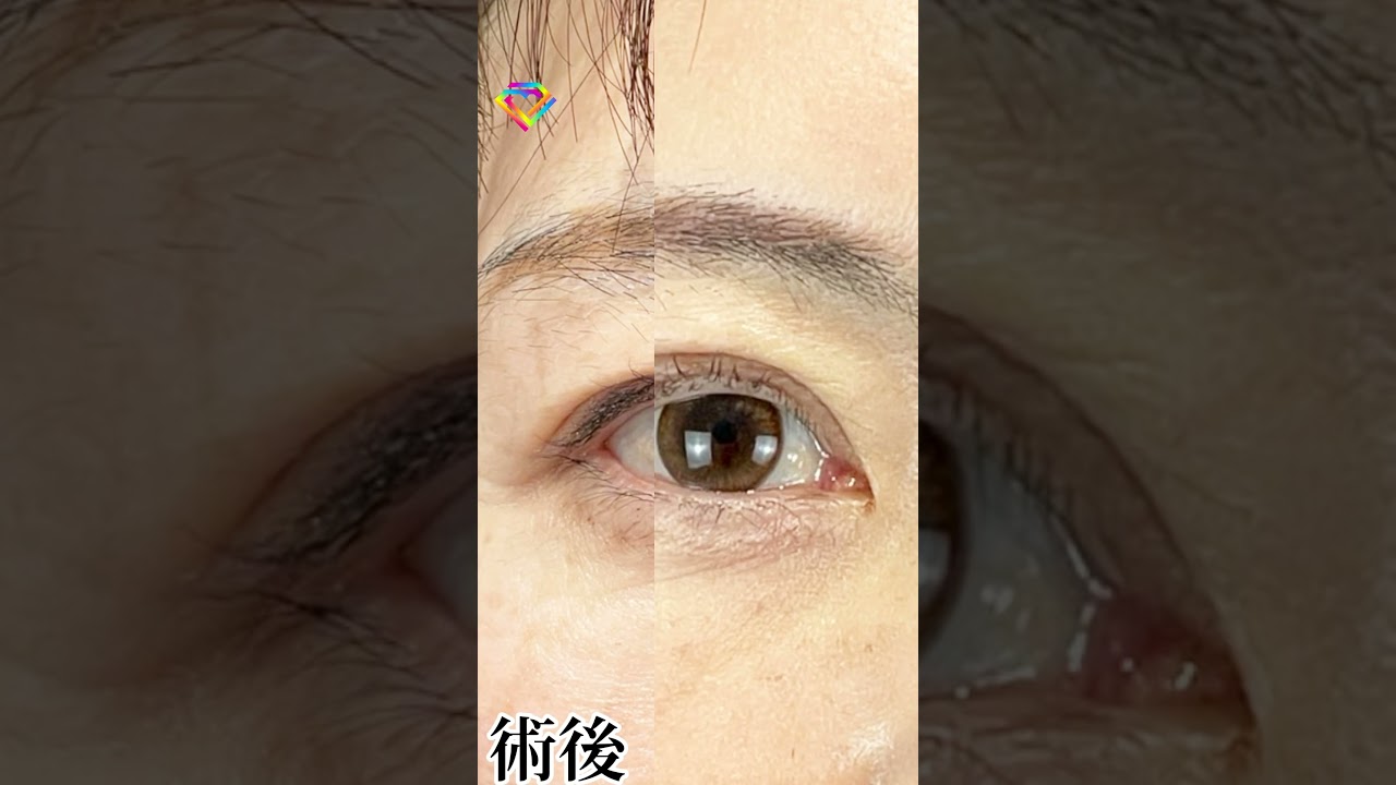 Youtubeのサムネイル