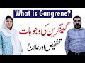 What Is Gangrene Causes Diagnosis And Its Treatment Dr Usman Jamil With Dr Arooj Azam