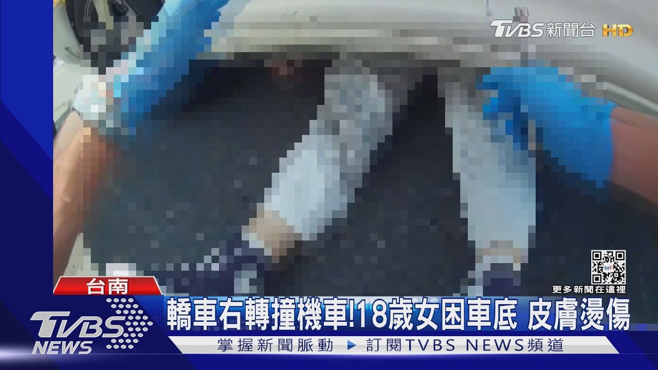 挨撞卻燙傷！柏油路溫度逾60度「燒燙燙」女騎士多處傷