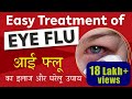 Eye Flu Treatment | Conjunctivitis - Cause, Prevention & Treatment | आई फ्लू का इलाज और घ