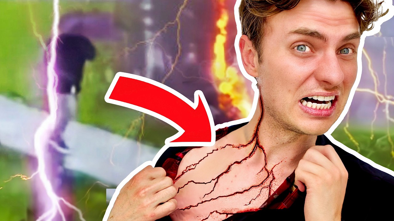 I GOT STRUCK BY LIGHTNING! (Lucky to be Alive)