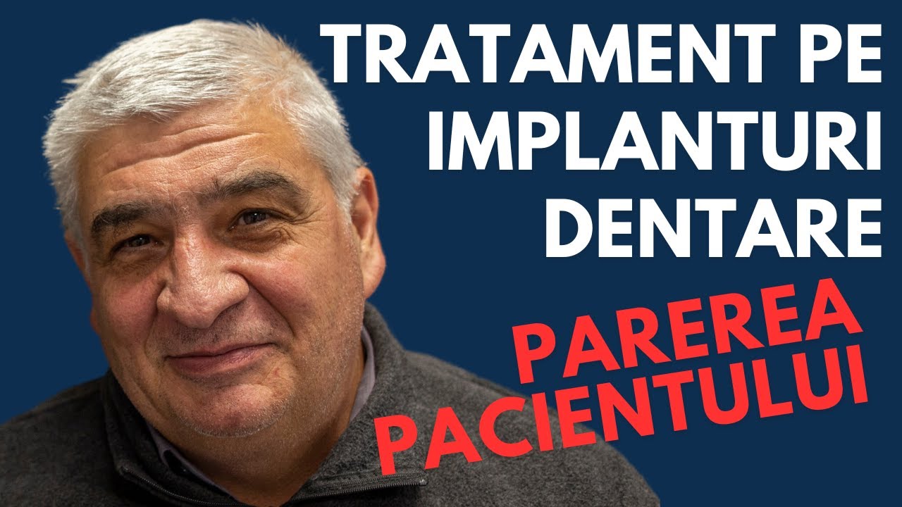 Pareri despre tratament cu proteza fixa pe implanturi | Dl. Dinu