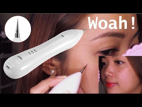 Warts and Mole Remover Pen... EFFECTIVE or NOT!?